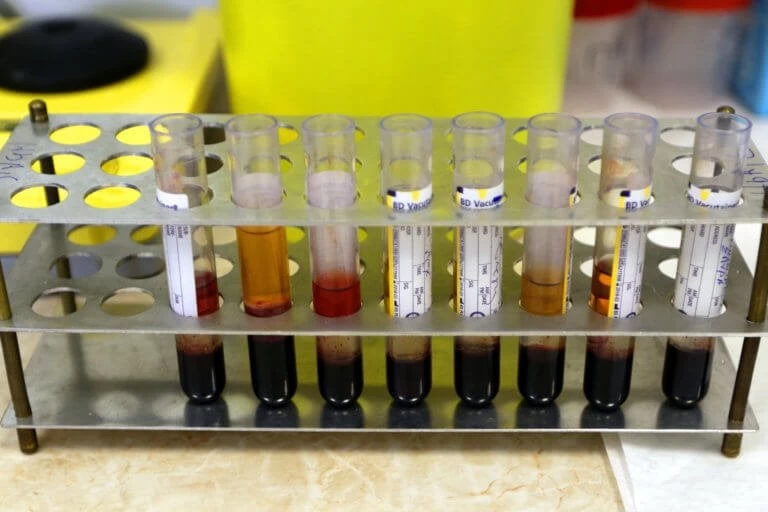 Γρίπη: Μετά τον σάλο «θυμήθηκε» το υπουργείο Υγείας να παραγγείλει άμεσα 50.000 αντιγριπικά εμβόλια!